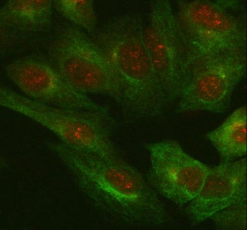 IL-18 Antibody