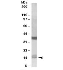 Western blot testing of K562 lysate with Prefoldin antibody at 1ug/ml. Predicted molecular weight: ~