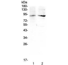 XPB Antibody