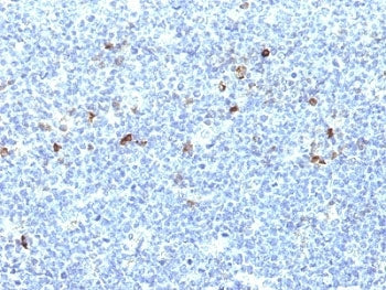 HLA-Aw32 + HLA-A25 Antibody