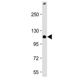 Western blot testing of mouse EL4 cell lysate with TCIRG1 antibody at 1:2000. Predicted molecular we