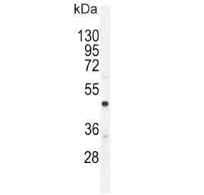 Chromogranin A Antibody