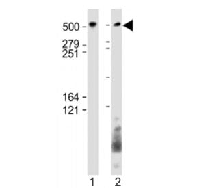 Western blot testing of BIRC6 antibody at 1:1000: Lane 1) huamn SH-SY5Y and 2) HeLa cell lysate. Pre