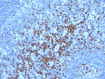 IHC staining of FFPE human lymph node tissue with TCF7 antibody (clone TCF7/7631). HIER: boil tissue