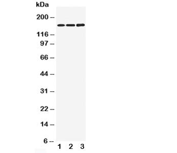 Western blot testing of NMDAR2B antibody and Lane 1: rat brain; 2: mouse brain; 3: human U87 cell ly