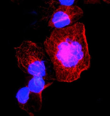 Alpha Tubulin Antibody / TUBA1A