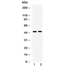 SERPINA5 Antibody / Protein C inhibitor
