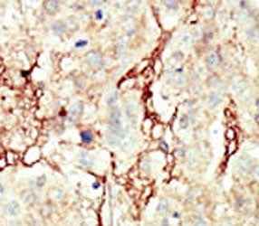 FGFR3 Antibody