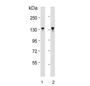 Western blot testing of human 1) Jurkat and 2) MOLT4 cell lysate with BCL11B antibody. Predicted molecular weight ~96 kDa but the modified forms of the protein can be observed at ~130 kDa.