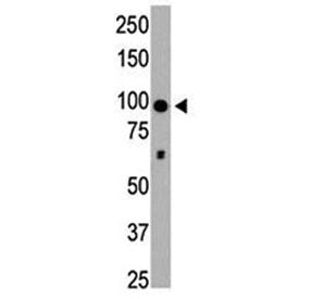 HDAC4 Antibody