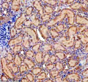 PELO Antibody / Protein pelota homolog, 100ug