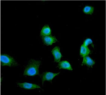 Galectin Antibody