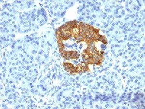 IHC testing of human pancreas stained with Insulin antibody (2D11-H5). Note cytoplasmic staining of 