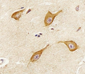 PIP4K2 alpha Antibody / PIP4K2A