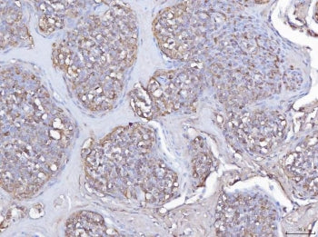 IHC staining of FFPE human tonsil tissue with PLEK antibody. HIER: boil tissue sections in pH8 EDTA 