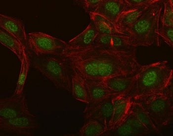 SLC8A1 Antibody / NCX1