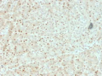 AKT1 Antibody