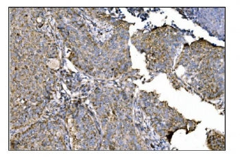 OAT Antibody / Ornithine aminotransferase