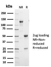 p53 Antibody / TP53