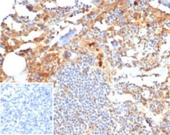 IHC staining of FFPE human tonsil tissue with MIG9 antibody (clone S100P/7374). Inset: PBS used in p