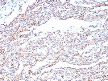 IHC staining of FFPE human heart tissue with NCAD antibody (clone CDH2/8815R). HIER: boil tissue sec