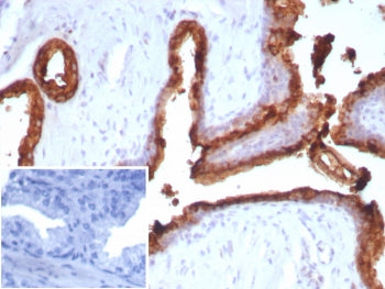 PSAP Antibody / Prostate Specific Acid Phosphatase