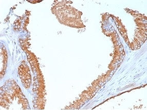 Glypican 3 Antibody / GPC3