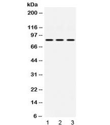 Western blot testing of 1) rat heart, 2) mouse NIH 3T3 and 3) human HeLa lysate with KRIT1 antibody 