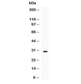 Western blot testing of recombinant mouse IL17 protein (0.5ng/lane) + tag with IL17 antibody at 0.5u