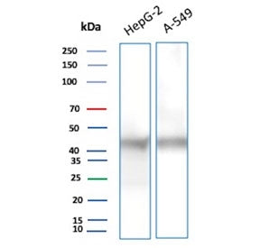 NSE Antibody / Neuron Specific Enolase