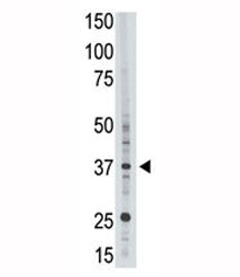 EPR1 Antibody