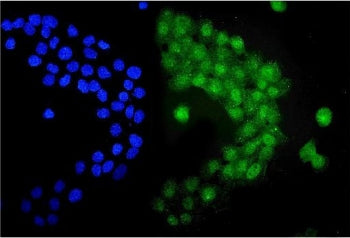 Immunofluorescent staining of FFPE human A431 cells with UBE1C antibody (green) and DAPI nuclear sta