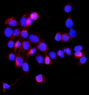 SHMT1 Antibody