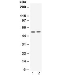 Western blot testing of 1) rat thymus and 2) human Jurkat lysate with VRK1 antibody. Predicted molec