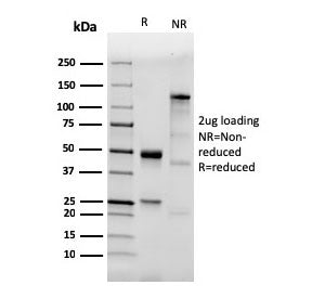 SDS-PAGE analysis of purified, BSA-free recombinant TLR2 antibody (clone TLR2/3894R) as confirmation