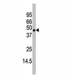 MAPK11 Antibody