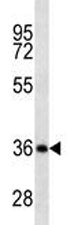 CD20 antibody western blot analysis in Ramos lysate.