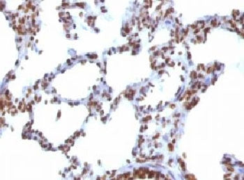 Nuclear Antigen Antibody