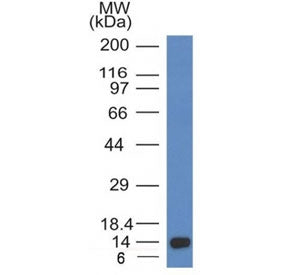 Western blot testing of a recombinant ALK partial protein using Anaplastic Lymphoma Kinase antibody 
