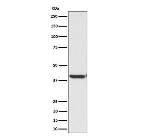 EXOG Antibody / ENDOGL1 / Endonuclease G-like 1