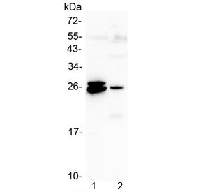 Western blot testing of 1) rat liver and 2) mouse liver lysate with GSTA antibody at 0.5ug/ml. Predi