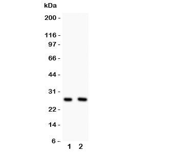 Western blot testing of Olig1 antibody and Lane 1: U87; 2: HeLa lysate