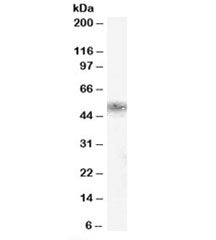 Western blot testing of human kidney lysate with KLK1 antibody at 0.5ug/ml. Predicted/observed molec