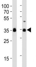 Western blot analysis of lysate from human NCCIT, mouse F9 cell line (left to right) using anti-SOX2