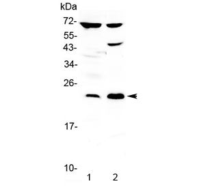 TRFP Antibody / MED20