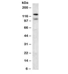 Western blot testing of human brain lysate with CDH2 antibody. Predicted molecular weight ~100 kDa (