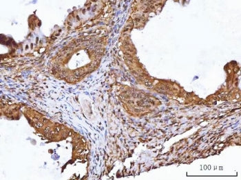 RuvB-like 1 Antibody / RUVBL1 / TIP49A