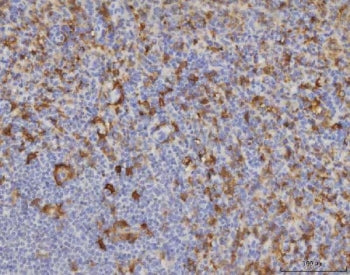 IHC staining of FFPE human spleen tissue with Malic enzyme 1 antibody. HIER: boil tissue sections in