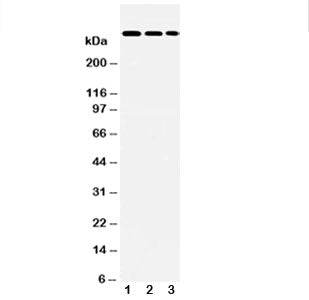 Western blot testing of LAMA2 antibody and Lane 1: HeLa; 2: A549; 3: PANC lysate. Predicted molecula