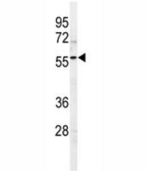 SPHK1 Antibody